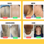 Turmeric Kojic Acid Pads (40 pcs)